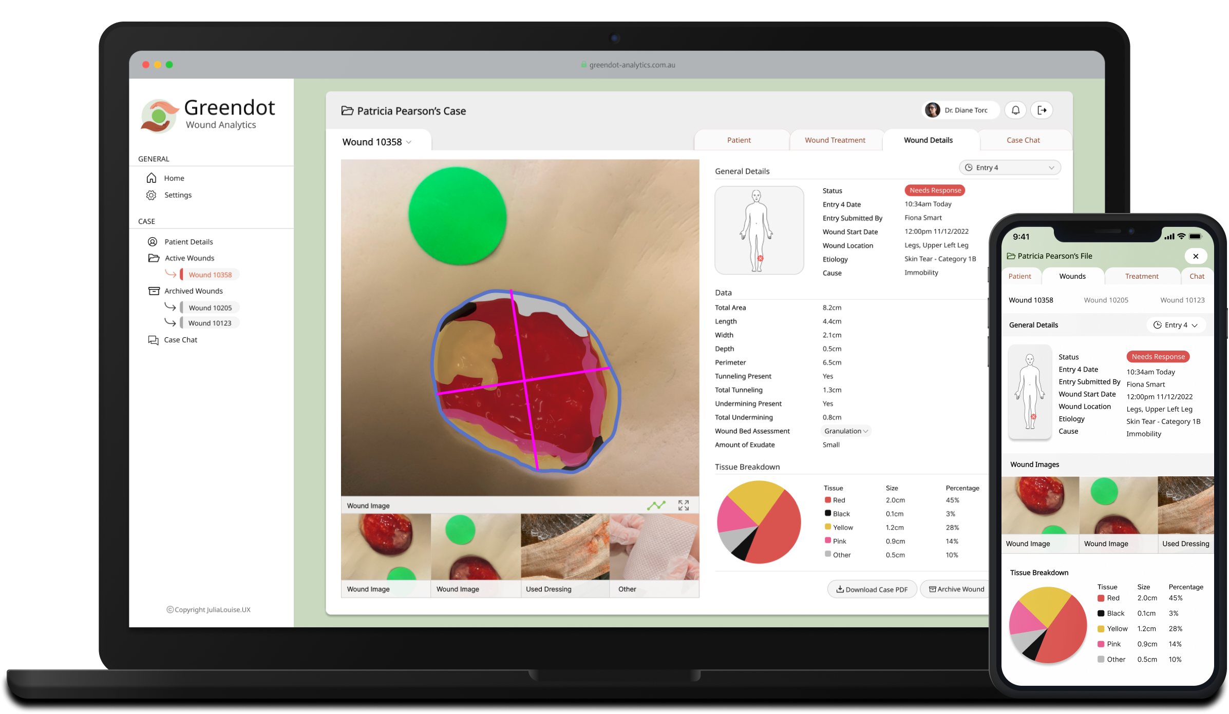 Greendot Analytics app shown on laptop and mobile screen